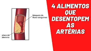 4 alimentos maravilhosos que desentopem as artérias! | Dr. Marco Menelau