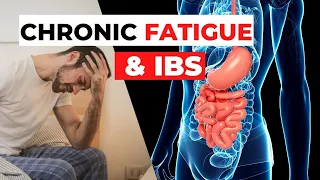 Dealing With Fatigue IBS: Effective Treatment Methods