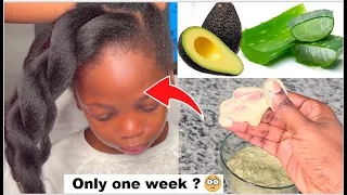 Intense Aloe Vera + Avocado protein treatment for massive hair growth. TRY NOW | SHOCKING RESULTS 😱