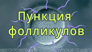 Пункция фолликулов