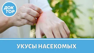 Чем опасны укусы насекомых