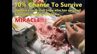10% Of Survival, This Is How The Medics Saved Vanellope Wilkins Life. Miracle!!