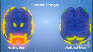 How to reset your addicted caveman brain FOREVER (scientific SECRETS)