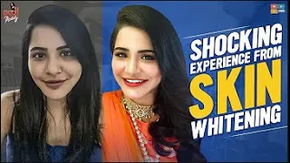 Skin Whitening Procedure on Ashu Reddy at Celebrity Secrets | Skin Whitening Treatment|