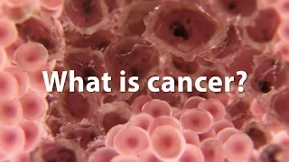 What is cancer? What causes cancer and how is it treated? *UPDATE*