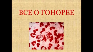 Гонорея. Гонорея у мужчин. Гонорея у женщин. Гонорея симптомы.