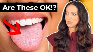what do BUMPS on your TONGUE mean?