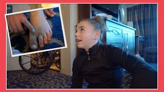 KATIE NEEDS SURGERY ON HER BROKEN TOE | Flippin' Katie