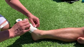 Big toe (2/2) taping after assessment for turf toe/sprains