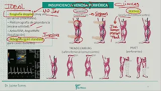 Cardiología - Insuficiencia venosa periferica   TVP