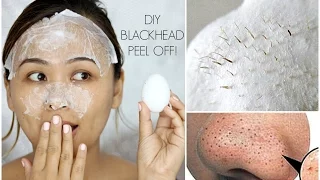 DIY Blackhead Peel Off Mask with an Egg | It Actually WORKS!