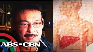 Mark Gil succumbed to liver cancer