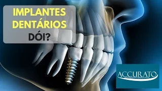 Implante Dentário | Dói