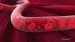 Medical animation | Diabetic Retinopathy animation | 3D Medical Animation