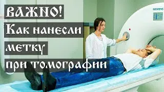 ВАЖНО! Как нанесли метку при томографии