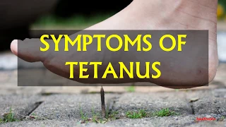SYMPTOMS OF TETANUS