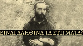 Στίγματα: Τα Σημάδια του Χριστού - Είναι Αληθινά ή Απάτη?