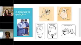 Efectos secundarios en el tratamiento del cáncer de vejiga