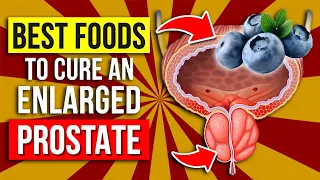 These Are The BEST and WORST Foods For Enlarged Prostate