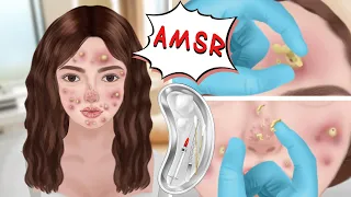 ASMR animation makeup and acne nose blackhead removal animation-Acne girl becomes beautiful여드름 제거