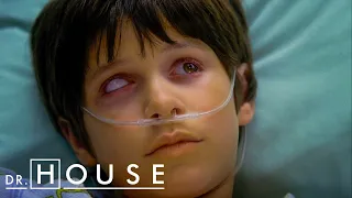 Würmer in den Augen | Dr. House DE
