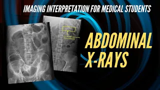 Abdominal X-ray Interpretation for Medical Students