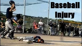 Horrible Hit By Pitch - Little League baseball injury