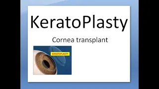 Ophthalmology 145 a Keratoplasty Cornea Transplant Eye donation Donor Surgery Indication Type Define