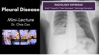 BASICS OF PLEURAL DISEASE: Mini-lecture, Dr. Chris Cox