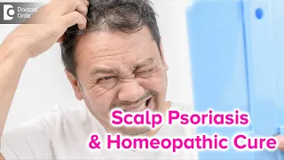 SCALP PSORIASIS | Causes, Symptoms & BEST HOMEOPATHIC REMEDY - Dr. Rashmi K | Doctors' Circle