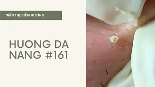 #161 | Huong Da Nang