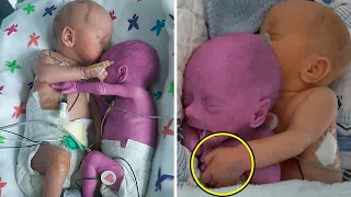 A Nurse Puts a Healthy Baby next to Its Dying Twin What Happened left Everyone Without Words