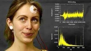 EEG artefacts: 'mind' or just muscle activity?