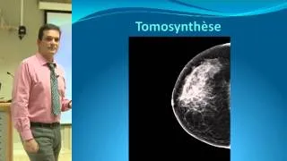 Mammographie 3D/Tomosynthèse