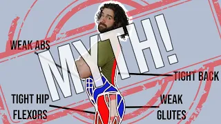 Debunked - Weak Glutes Cause Anterior Pelvic Tilt! - (Find out the REAL cause)