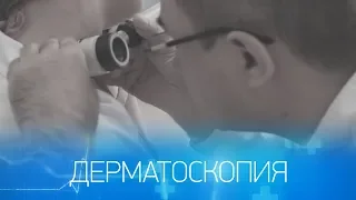 Родинка. Удалить нельзя оставить?