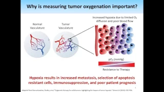 November 2016 Webinar: Photoacoustic Imaging of Tumor Oxygenation: Validation with MRI