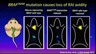 Treating Advanced Thyroid Carcinoma: Moving Beyond (and back to) Radioiodine