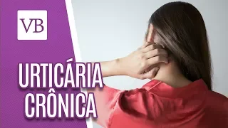 Urticária Crônica Espontânea: Diagnóstico e Tratamentos - Você Bonita (17/04/18)