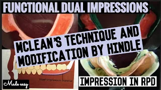 McLEAN'S TECHNIQUE II FUNCTIONAL DUAL IMPRESSION IISECONDARY IMPRESSION IN REMOVABLE PARTIAL DENTURE