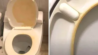 How to remove yellow stains from a toilet seat?