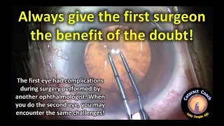 Give the first cataract surgeon the benefit of the doubt!