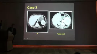 INCIDENTAL SPLENIC LESIONS - Shmuel MEIRSDORF