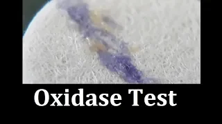 Oxidase test (Protocol)