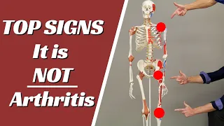 Top 5 Signs Your Shoulder, Hip, or Knee Pain, Is NOT Arthritis