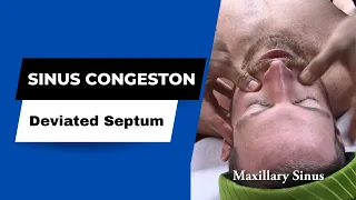 Sinus congestion, sinus adjustment HELPED by Dr Suh at Specific Chiropractic NYC