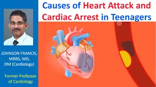 Causes of heart attack and cardiac arrest in teenagers