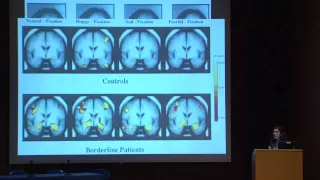 BPD-related cognitive-perceptual difficulties and challenges in their diagnosis and treatment