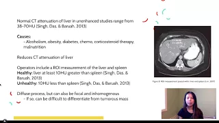 Unenhanced  Abdomen Pelvic CT Scan