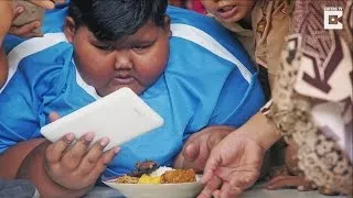 Morbidly Obese Boy Who Once Weighed 423 Pounds Gets Weight Loss Surgery